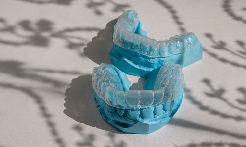 Image article blog Invisalign: Prix et Remboursement en 2023