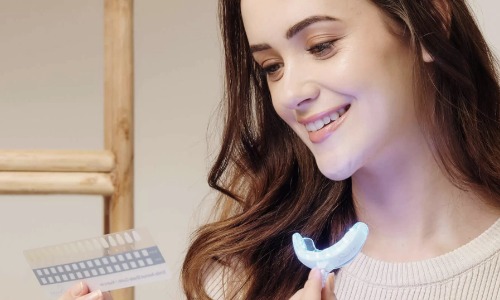 Image article blog Kit de blanchiment Smile Avenue : Test complet et Avis